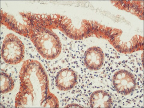 抗-封闭素抗体 来源于兔 affinity isolated antibody