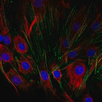 Anti-SCA-1 Antibody from rabbit, purified by affinity chromatography