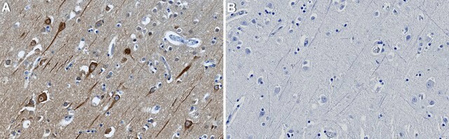 Anti-PHACTR1 Antibody, clone 2B15 ZooMAb&#174; Rabbit Monoclonal recombinant, expressed in HEK 293 cells