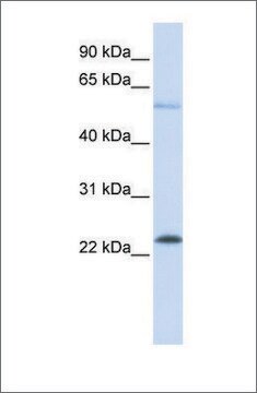 抗-KRAS affinity isolated antibody