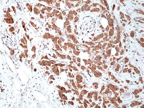 Anti-Musashi 2 (MSI2) Rabbit Monoclonal Antibody clone RM422, affinity purified immunoglobulin