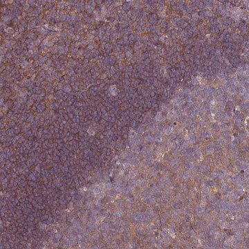 Anti-STK38L antibody produced in rabbit Prestige Antibodies&#174; Powered by Atlas Antibodies, affinity isolated antibody, buffered aqueous glycerol solution