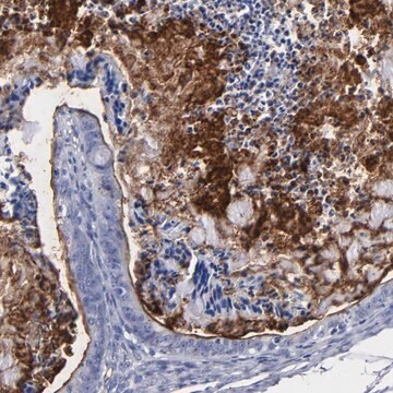 Anti-TM4SF1 antibody produced in rabbit Prestige Antibodies&#174; Powered by Atlas Antibodies, affinity isolated antibody, buffered aqueous glycerol solution