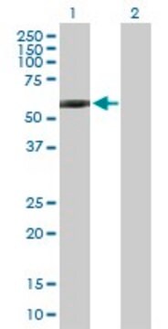 抗GPI抗体 マウス宿主抗体 IgG fraction of antiserum, buffered aqueous solution