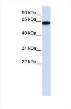 抗CHAT抗体 affinity isolated antibody