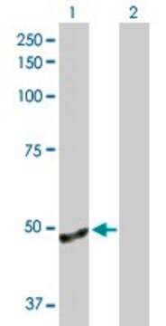 Anti-ANGPTL4 antibody produced in rabbit purified immunoglobulin, buffered aqueous solution