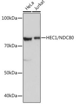 Anti-HEC1/NDC80 Antibody, clone 4W2Y2, Rabbit Monoclonal