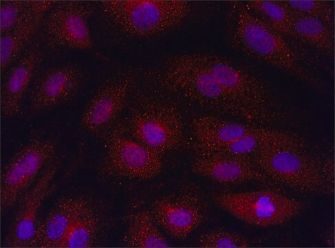 Anti-SMOX (151-165) antibody produced in rabbit IgG fraction of antiserum