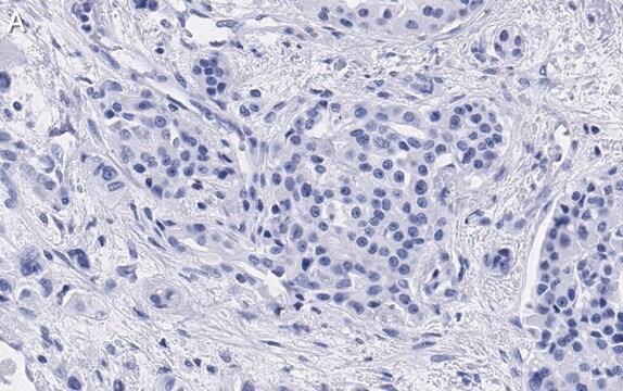 抗サイクリンD1抗体 クローン1J9 ZooMAb&#174;ウサギ・モノクローナル recombinant, expressed in HEK 293 cells