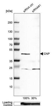 Monoclonal Anti-CNP antibody produced in mouse Prestige Antibodies&#174; Powered by Atlas Antibodies, clone CL2871, purified immunoglobulin, buffered aqueous glycerol solution