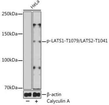 Anti-phospho-LATS1-T1079/LATS2-T1041