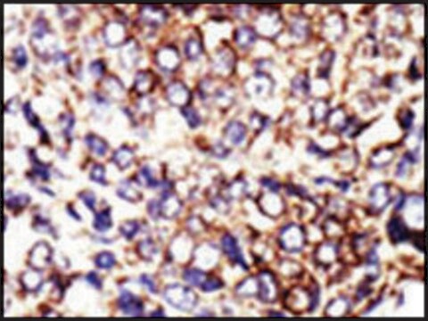 Anti-AGL (N-term) antibody produced in rabbit IgG fraction of antiserum, buffered aqueous solution