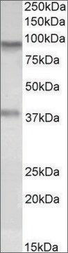 Anti-AOC3 antibody produced in goat affinity isolated antibody, buffered aqueous solution