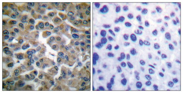 Anti-I&#954;B-&#949; antibody produced in rabbit affinity isolated antibody