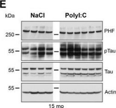 Anti-Actin Antibody, smooth muscle &#947; &amp; &#945; actin, clone CGA7 ascites fluid, clone CGA7, Chemicon&#174;