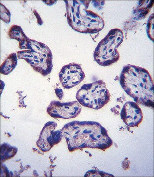 ANTI-TM4SF18 (CENTER) antibody produced in rabbit IgG fraction of antiserum, buffered aqueous solution