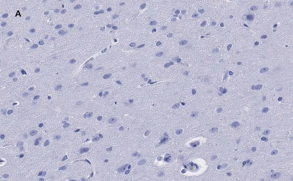 抗GFAP抗体 クローン2E8 ZooMAb&#174;ウサギモノクローナル recombinant, expressed in HEK 293 cells