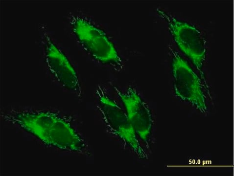 抗UQCRC1抗体 マウス宿主抗体 purified immunoglobulin, buffered aqueous solution