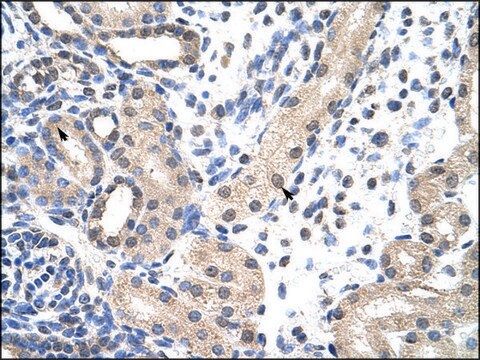 抗SNRPD1抗体 ウサギ宿主抗体 affinity isolated antibody