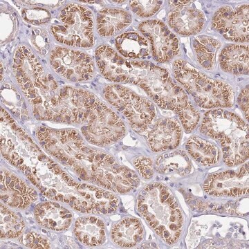 Anti-CMKLR1 antibody produced in rabbit Prestige Antibodies&#174; Powered by Atlas Antibodies, affinity isolated antibody, buffered aqueous glycerol solution