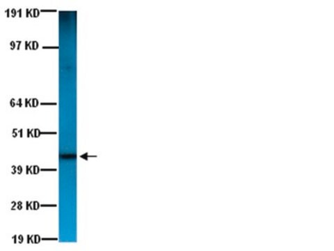 Anticorps anti-actine (de muscle lisse), clone&nbsp;ASM-1 clone ASM-1, Chemicon&#174;, from mouse