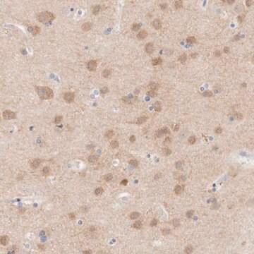 Anti-MPP2 antibody produced in rabbit Prestige Antibodies&#174; Powered by Atlas Antibodies, affinity isolated antibody, buffered aqueous glycerol solution