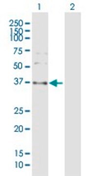 Anti-SPARC antibody produced in rabbit purified immunoglobulin, buffered aqueous solution