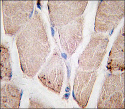 Anti-PYGM (C-term) antibody produced in rabbit Ig fraction of antiserum, buffered aqueous solution