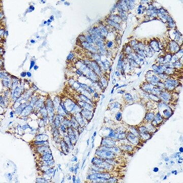 Anti-TNFAIP3 antibody produced in rabbit