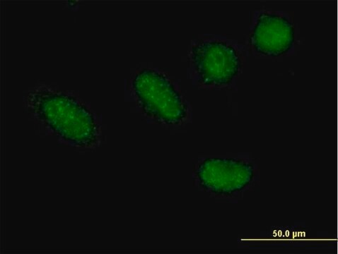 Anti-GRHL2 antibody produced in mouse purified immunoglobulin, buffered aqueous solution