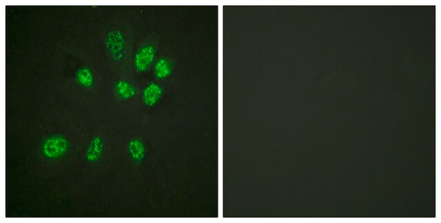 抗-雌激素受体-&#946; 兔抗 affinity isolated antibody