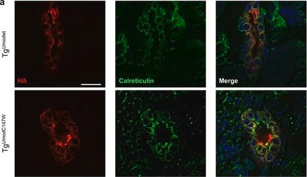 Anti-Calreticulin antibody produced in rabbit IgG fraction of antiserum, buffered aqueous solution