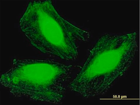 Anti-ARMC1 antibody produced in mouse purified immunoglobulin, buffered aqueous solution