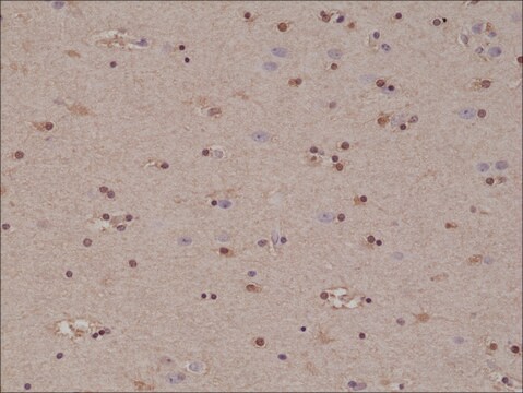 Anti-S100-beta antibody, Rabbit Monoclonal recombinant, expressed in HEK 293 cells, clone RM304, purified immunoglobulin