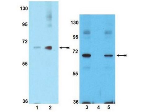 Anticorpo anti-fosfo-PAK1 (Ser199/Ser204) Upstate&#174;, from rabbit