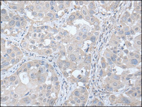 Anti-UBE2Q2 affinity isolated antibody