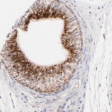 抗PDE4B抗体 ウサギ宿主抗体 Prestige Antibodies&#174; Powered by Atlas Antibodies, affinity isolated antibody, buffered aqueous glycerol solution