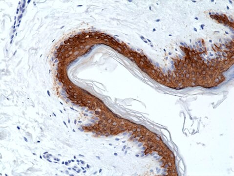 Królicze przeciwciało monoklonalne anty-CK10(cytokeratyna-10) clone RM386, purified immunoglobulin