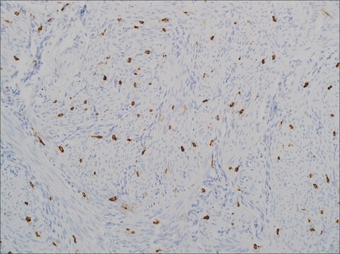 Tryptase (EP259) Rabbit Monoclonal Primary Antibody