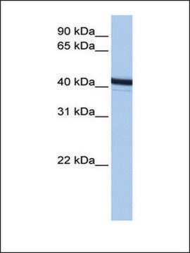 Anti-ACTR1B antibody produced in rabbit affinity isolated antibody