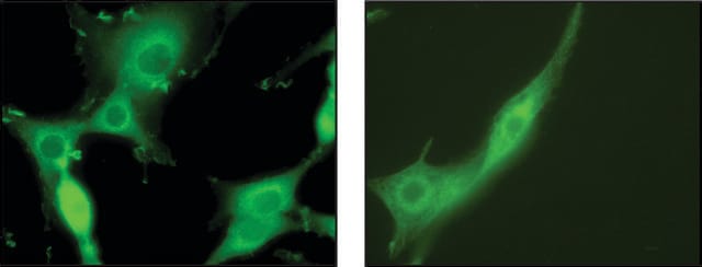 Anti-Syntaxin 7 antibody produced in rabbit IgG fraction of antiserum, buffered aqueous solution