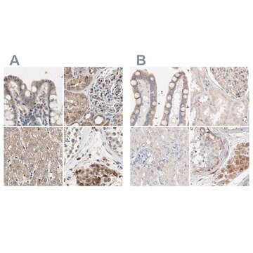 抗PROS1抗体 ウサギ宿主抗体 Prestige Antibodies&#174; Powered by Atlas Antibodies, affinity isolated antibody, buffered aqueous glycerol solution