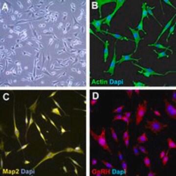 Linia komórkowa mysich neuronów GnRH GN11 The GN11 mouse neuronal cell line is an immortalized cell line established as a model of GnRH-secreting neurons.