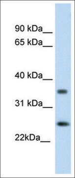 Anti-FADD (AB2) antibody produced in rabbit affinity isolated antibody