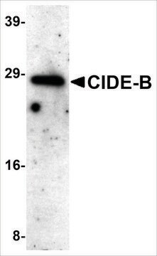 Anti-CIDE-B (ab3) antibody produced in rabbit affinity isolated antibody, buffered aqueous solution