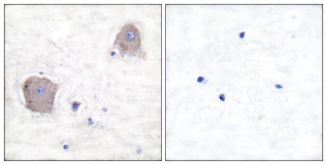 Anti-MGLUR4 antibody produced in rabbit affinity isolated antibody