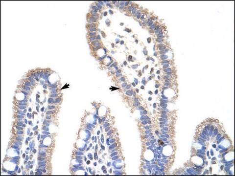 Anti-METTL3 (AB2) antibody produced in rabbit IgG fraction of antiserum