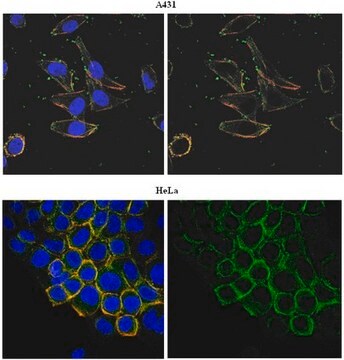 Anti-PORCN Antibody, clone 15G12.1 clone 15G12.1, from mouse