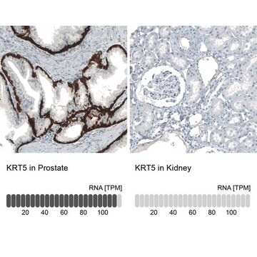 Monoclonal Anti-KRT5 antibody produced in mouse Prestige Antibodies&#174; Powered by Atlas Antibodies, clone CL9297, purified immunoglobulin, buffered aqueous glycerol solution