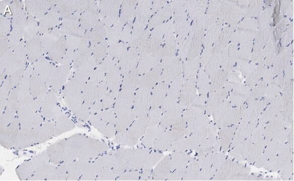 Anti-Myosin Heavy Chain 7 Antibody, clone 1B19, ZooMAb&#174; Rabbit Monoclonal recombinant, expressed in HEK 293 cells